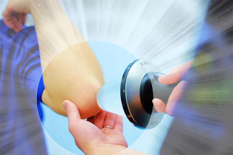 体外衝撃波治療(集束型・拡散型)